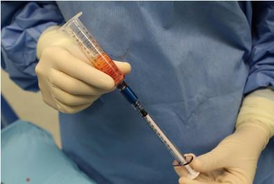 cirugia de rejuvenecimiento facial 3 doctor javier martin rodriguez maxilofacial donostia san sebastian eibar gipuzkoa